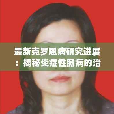 最新克罗恩病研究进展:揭秘炎症性肠病的治疗新篇章