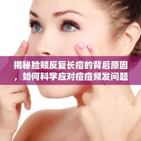 揭秘脸颊反复长痘的背后原因,如何科学应对痘痘频发问题?