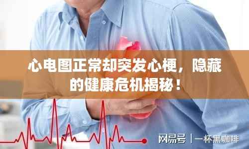 心电图正常却突发心梗,隐藏的健康危机揭秘!