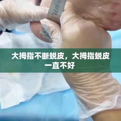 大拇指不断蜕皮,大拇指蜕皮一直不好