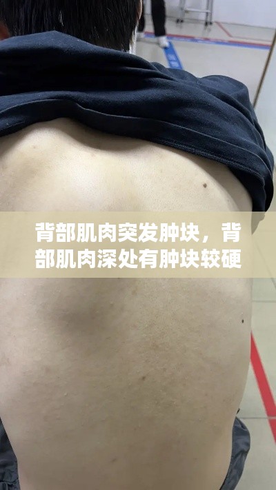 背部肌肉突发肿块,背部肌肉深处有肿块较硬