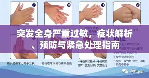 突发全身严重过敏，症状解析、预防与紧急处理指南