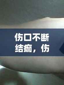伤口不断结痂,伤口不断结痂怎么办
