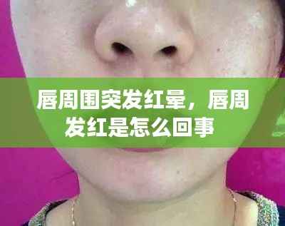 唇周围突发红晕,唇周发红是怎么回事