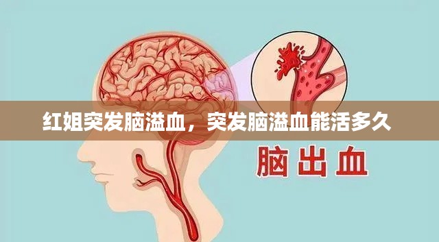 红姐突发脑溢血,突发脑溢血能活多久