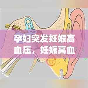 孕妇突发妊娠高血压,妊娠高血压是突发性的吗