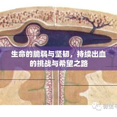 生命的脆弱与坚韧,持续出血的挑战与希望之路