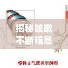 揭秘咳嗽不断喘息背后的真相!