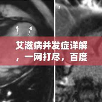 艾滋病并发症详解,一网打尽,百度来揭秘!