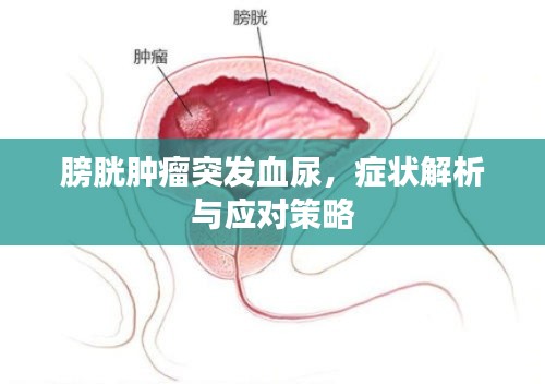 膀胱肿瘤突发血尿,症状解析与应对策略