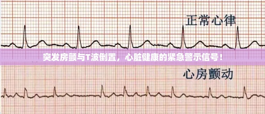 突发房颤与T波倒置,心脏健康的紧急警示信号!