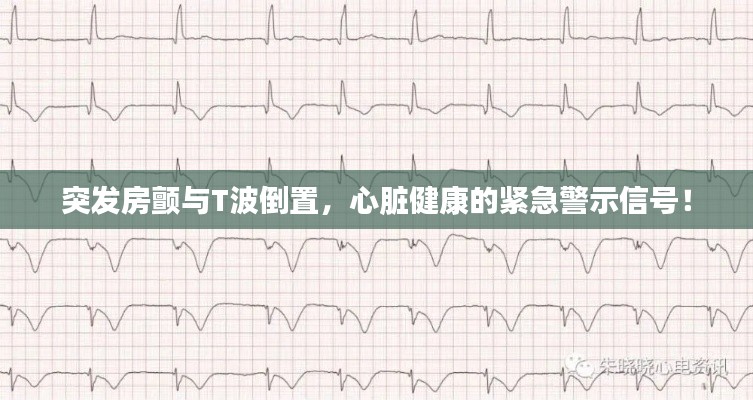 突发房颤与T波倒置,心脏健康的紧急警示信号!